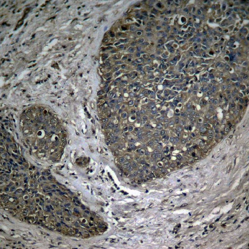 弘晉有限公司-Signalway Antibody(SAB)台灣代理